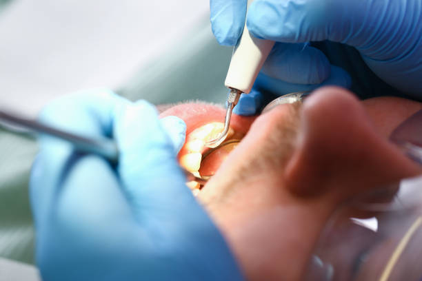 Best Pediatric Emergency Dentist in Le Claire, IA
